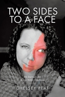 Two Sides to a Face: My Journey with Sturge Weber Syndrome 0228831679 Book Cover