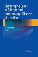 Challenging Cases in Allergic and Immunologic Diseases of the Skin 1489981810 Book Cover