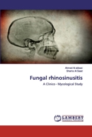 Fungal rhinosinusitis 6202527072 Book Cover