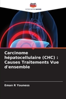 Carcinome hépatocellulaire (CHC): Causes Traitements Vue d'ensemble (French Edition) 6208341132 Book Cover