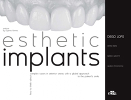 Esthetic Implants How to think about complex cases in anterior areas with a global approach to the patient smile 882145326X Book Cover