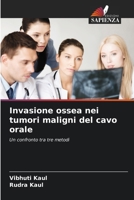 Invasione ossea nei tumori maligni del cavo orale (Italian Edition) 6207689232 Book Cover