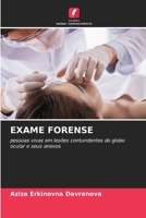EXAME FORENSE: pessoas vivas em lesões contundentes do globo ocular e seus anexos 6206362515 Book Cover