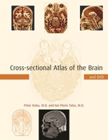 Cross-sectional Atlas of the Brain and DVD 0674019237 Book Cover
