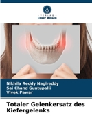 Totaler Gelenkersatz des Kiefergelenks (German Edition) 6209873278 Book Cover
