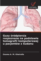 Guzy sródpiersia rozpoznane na podstawie tomografii komputerowej u pacjentów z Sudanu (Polish Edition) 6630274989 Book Cover