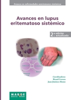 Avances en lupus eritematoso sistémico (Spanish Edition) 8415340206 Book Cover