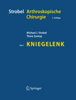 Strobel Arthroskopische Chirurgie: Teil I: Kniegelenk 3642415520 Book Cover