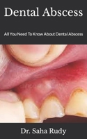 Dental Abscess: All You Need To Know About Dental Abscess null Book Cover