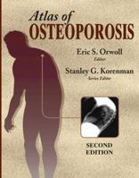 Atlas of Osteoporosis 1573402966 Book Cover