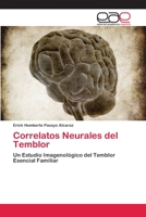 Correlatos Neurales del Temblor: Un Estudio Imagenológico del Temblor Esencial Familiar 3659046744 Book Cover