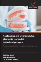 Postepowanie w przypadku zlamania narzedzi endodontycznych (Polish Edition) 6202423501 Book Cover