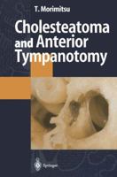 Cholesteatoma and Anterior Tympanotomy 4431684417 Book Cover