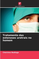 Tratamento das estenoses uretrais no homem (Portuguese Edition) 6630298152 Book Cover