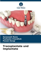 Transplantate und Implantate (German Edition) B0CL8D4S4Q Book Cover
