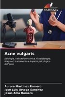 Acne vulgaris (Italian Edition) 6630363795 Book Cover