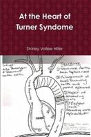At the Heart of Turner Syndrome 1304674231 Book Cover