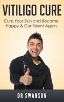 Vitiligo Cure: Cure your Skin and Become Happy & Confident Again (Vitiligo, Skin Pigment, Pigmentation, Vitiligo Cure, Vitiligo Cream, Skin Condition, Skin Care, Beauty) 1502787180 Book Cover