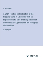 A Short Treatise on the Section of the Prostate Gland in Lithotomy; With an Explanation of a Safe and Easy Method of Conducting the Operation on the Principles of Cheselden: in large print 338707204X Book Cover