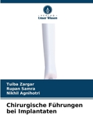 Chirurgische Führungen bei Implantaten (German Edition) 6630011112 Book Cover