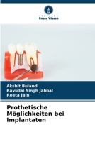 Prothetische Möglichkeiten bei Implantaten 6209455891 Book Cover
