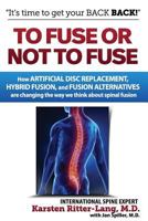 To Fuse or Not to Fuse: How Artificial Disc Replacement, Hybrid Fusion, and Fusion Alternatives Are Changing the Way We Think about Spinal Fusion 1543155030 Book Cover