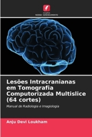 Lesões Intracranianas em Tomografia Computorizada Multislice (64 cortes) (Portuguese Edition) 6207672178 Book Cover
