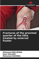 Fractures of the proximal quarter of the tibia treated by external fixator 6205898802 Book Cover