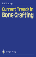 Current Trends in Bone Grafting 3540501398 Book Cover