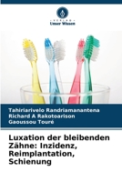 Luxation der bleibenden Zähne: Inzidenz, Reimplantation, Schienung 6205917084 Book Cover