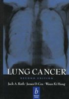 Lung Cancer 1118468740 Book Cover