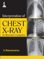 Interpretation of Chest X-Ray: An Illustrated Companion 9351521729 Book Cover