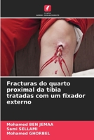 Fracturas do quarto proximal da tíbia tratadas com um fixador externo 6205899493 Book Cover