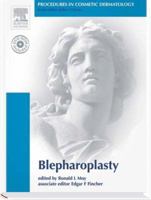 Procedures in Cosmetic Dermatology Series: Blepharoplasty: Textbook with DVD 1416029966 Book Cover