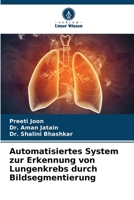 Automatisiertes System zur Erkennung von Lungenkrebs durch Bildsegmentierung 6205966670 Book Cover