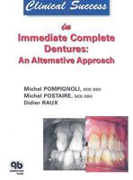 Clinical Success in Immediate Complete Dentures: An Alternative Approach 2912550572 Book Cover