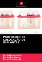 Protocolo de Colocação de Implantes 6203607487 Book Cover