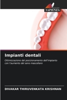 Impianti dentali: Ottimizzazione del posizionamento dell'impianto con l'aumento del seno mascellare 6206001547 Book Cover