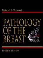 Pathology of The Breast 0838577040 Book Cover