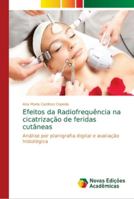 Efeitos da Radiofrequência na cicatrização de feridas cutâneas: Análise por planigrafia digital e avaliação histológica 6139635128 Book Cover