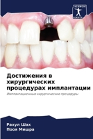 Достижения в хирургических процедурах имплантации: Имплантационные хирургические процедуры 6207635248 Book Cover