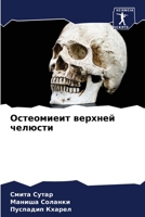 Oстеомиеит верхней челюсти 6206076288 Book Cover