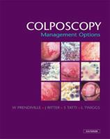 Colposcopy: Management Options 0702024910 Book Cover