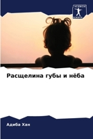Расщелина губы и нёба 6205872722 Book Cover