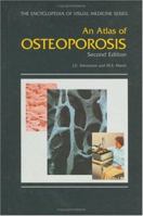 Atlas of Osteoporosis (Encyclopedia of Visual Medicine) 0367452812 Book Cover