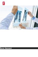 Taxas de recorrência do cancro após cirurgia conservadora da mama 6209317243 Book Cover