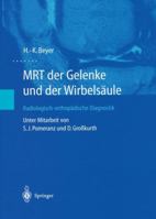 Mrt Der Gelenke Und Der Wirbelsaule: Radiologisch-Orthopadische Diagnostik 3540436022 Book Cover