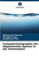 Computertomographie mit abgestimmter Apertur in der Zahnmedizin (German Edition) 6209838448 Book Cover