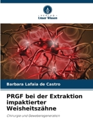 PRGF bei der Extraktion impaktierter Weisheitszähne 6209452264 Book Cover