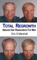 Total Regrowth: Natural Hair Restoration For Men 1500844047 Book Cover